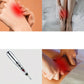 Stylo de Massage Électrique à Point d’Acupuncture | Soulagement de la Douleur & Soin Beauté